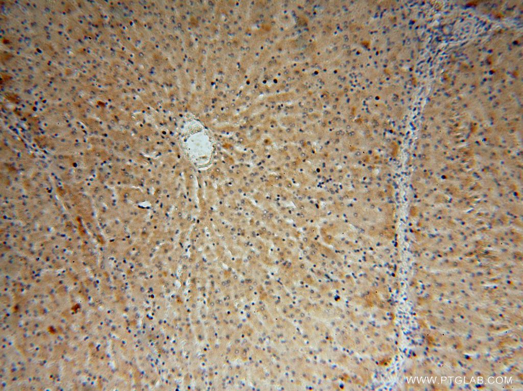 Immunohistochemistry (IHC) staining of human liver tissue using GGCX Polyclonal antibody (16209-1-AP)