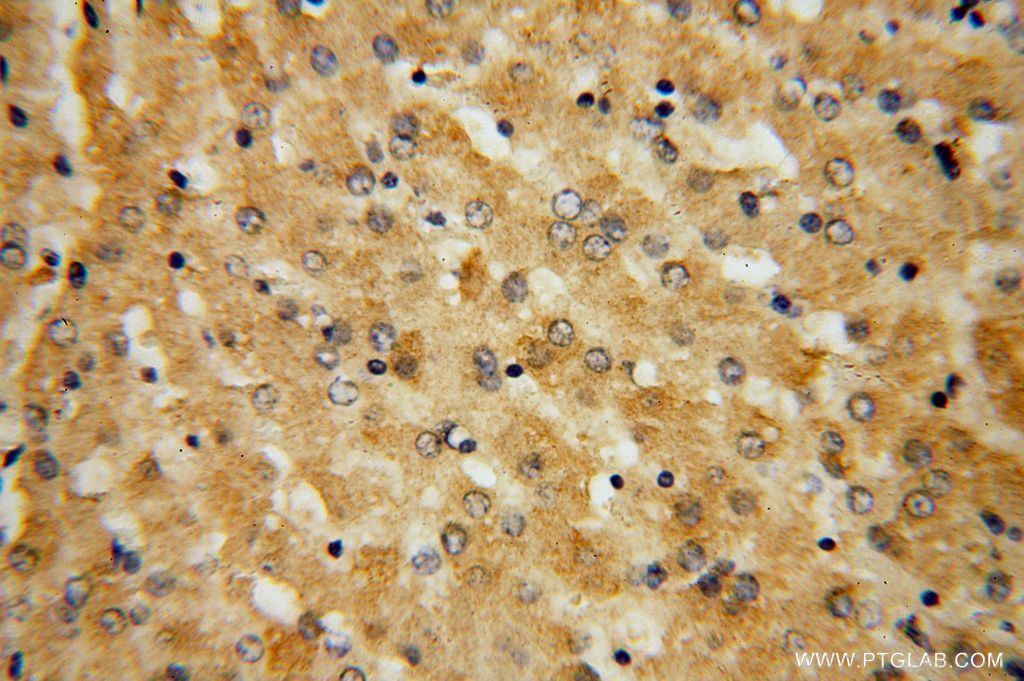 Immunohistochemistry (IHC) staining of human liver tissue using GGCX Polyclonal antibody (16209-1-AP)