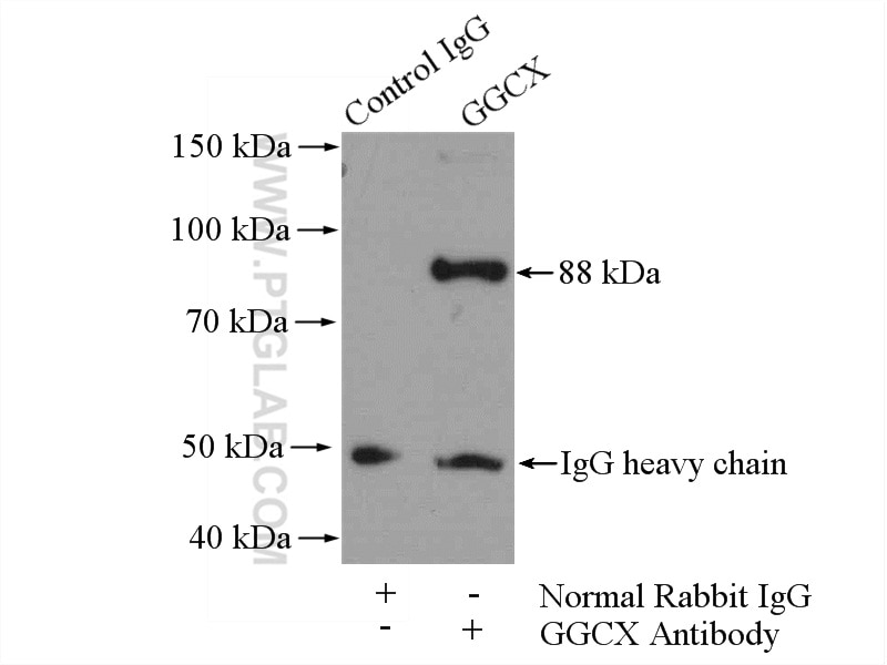Immunoprecipitation (IP) experiment of mouse liver tissue using GGCX Polyclonal antibody (16209-1-AP)