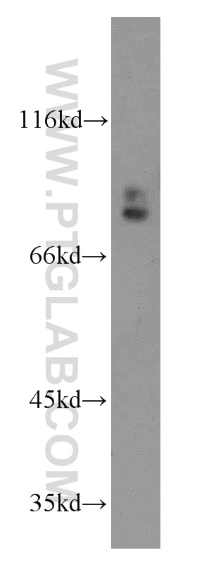 Western Blot (WB) analysis of PC-3 cells using GGCX Polyclonal antibody (16209-1-AP)