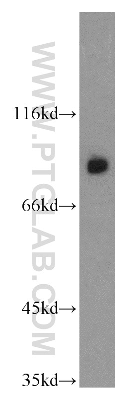 Western Blot (WB) analysis of mouse liver tissue using GGCX Polyclonal antibody (16209-1-AP)