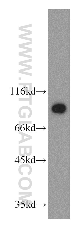 Western Blot (WB) analysis of HEK-293 cells using GGCX Polyclonal antibody (16209-1-AP)