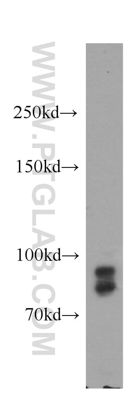 Western Blot (WB) analysis of PC-3 cells using GGCX Polyclonal antibody (16209-1-AP)