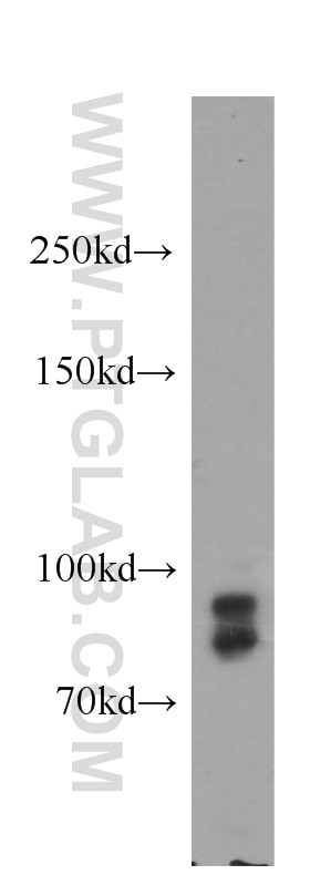 WB analysis of PC-3 using 16209-1-AP