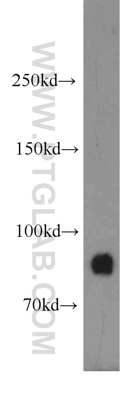 Western Blot (WB) analysis of mouse liver tissue using GGCX Polyclonal antibody (16209-1-AP)