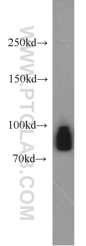 Western Blot (WB) analysis of MCF-7 cells using GGCX Polyclonal antibody (16209-1-AP)