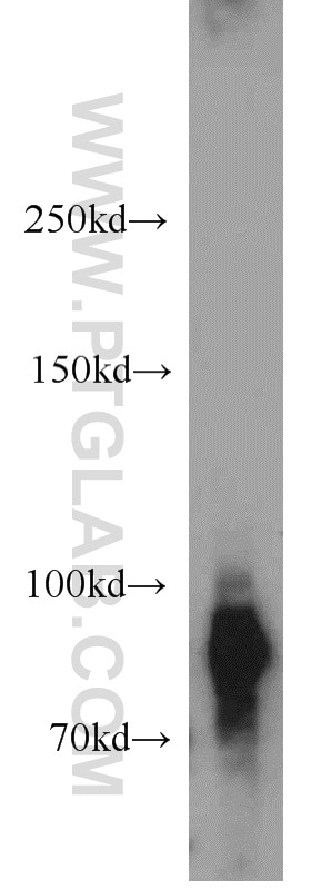 Western Blot (WB) analysis of L02 cells using GGCX Polyclonal antibody (16209-1-AP)