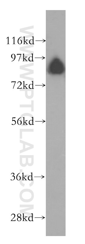 Western Blot (WB) analysis of HepG2 cells using GGCX Polyclonal antibody (16209-1-AP)