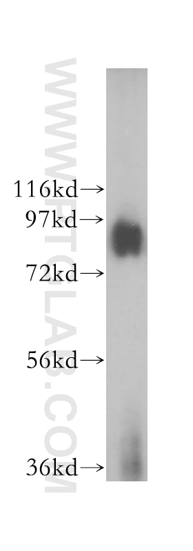 Western Blot (WB) analysis of MCF-7 cells using GGCX Polyclonal antibody (16209-1-AP)