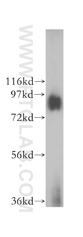 WB analysis of MCF-7 using 16209-1-AP