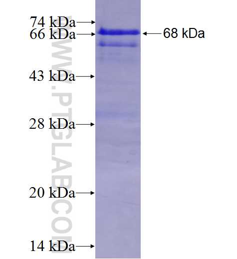 GGCX fusion protein Ag9185 SDS-PAGE