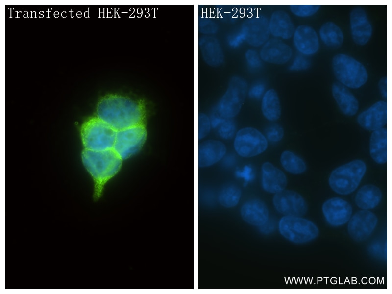 Immunofluorescence (IF) / fluorescent staining of Transfected HEK-293T cells using Anti-  GGGGS Linker Rabbit Recombinant Antibody (98262-1-RR)