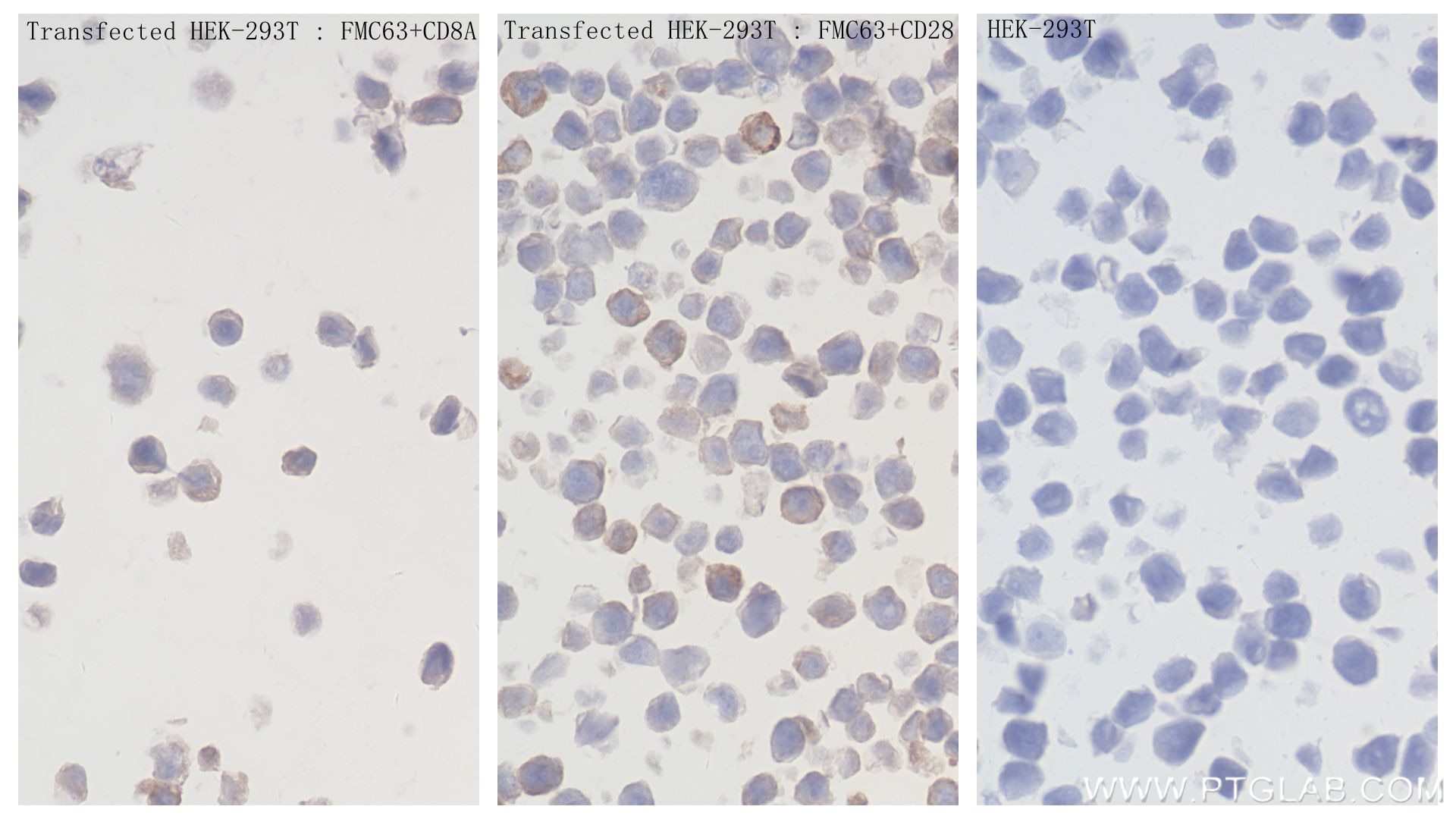 Immunohistochemistry (IHC) staining of Transfected HEK-293T cells using Anti-  GGGGS Linker Rabbit Recombinant Antibody (98262-1-RR)