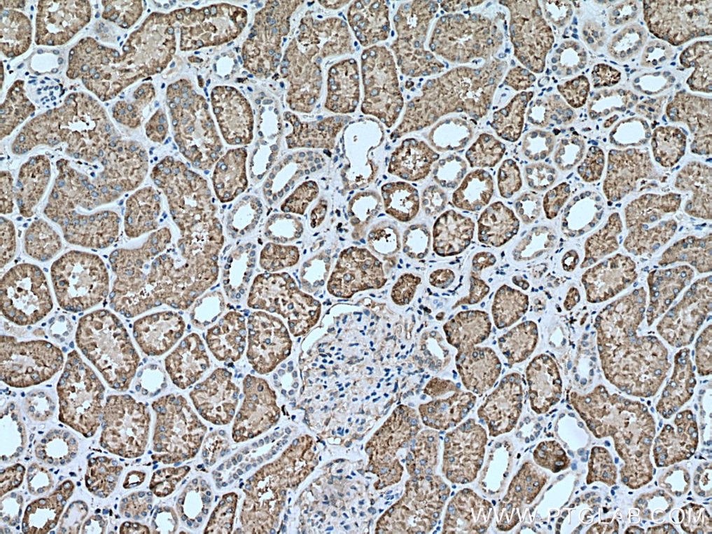 Immunohistochemistry (IHC) staining of human kidney tissue using GGH Polyclonal antibody (13264-1-AP)