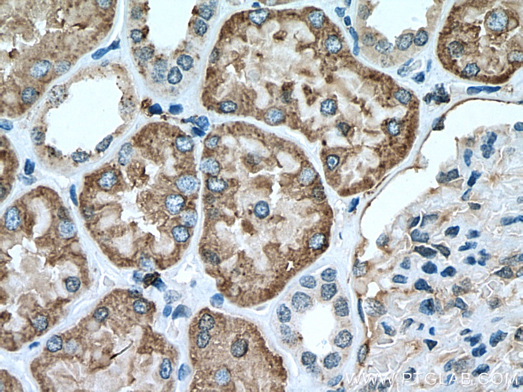 Immunohistochemistry (IHC) staining of human kidney tissue using GGH Polyclonal antibody (13264-1-AP)