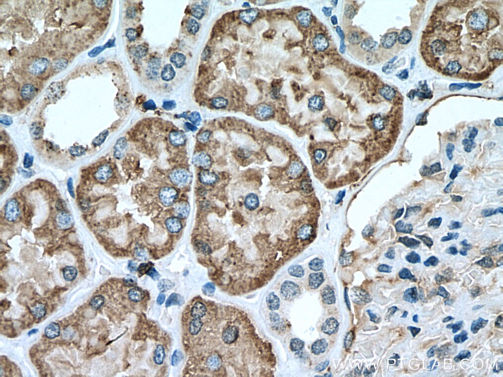 IHC staining of human kidney using 13264-1-AP