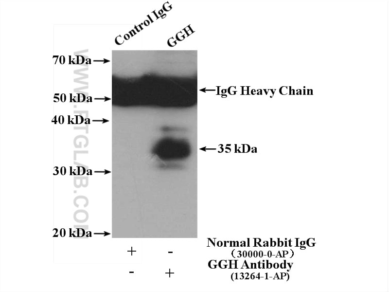 Immunoprecipitation (IP) experiment of HepG2 cells using GGH Polyclonal antibody (13264-1-AP)