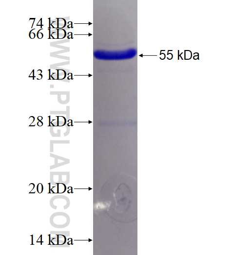 GGH fusion protein Ag3939 SDS-PAGE