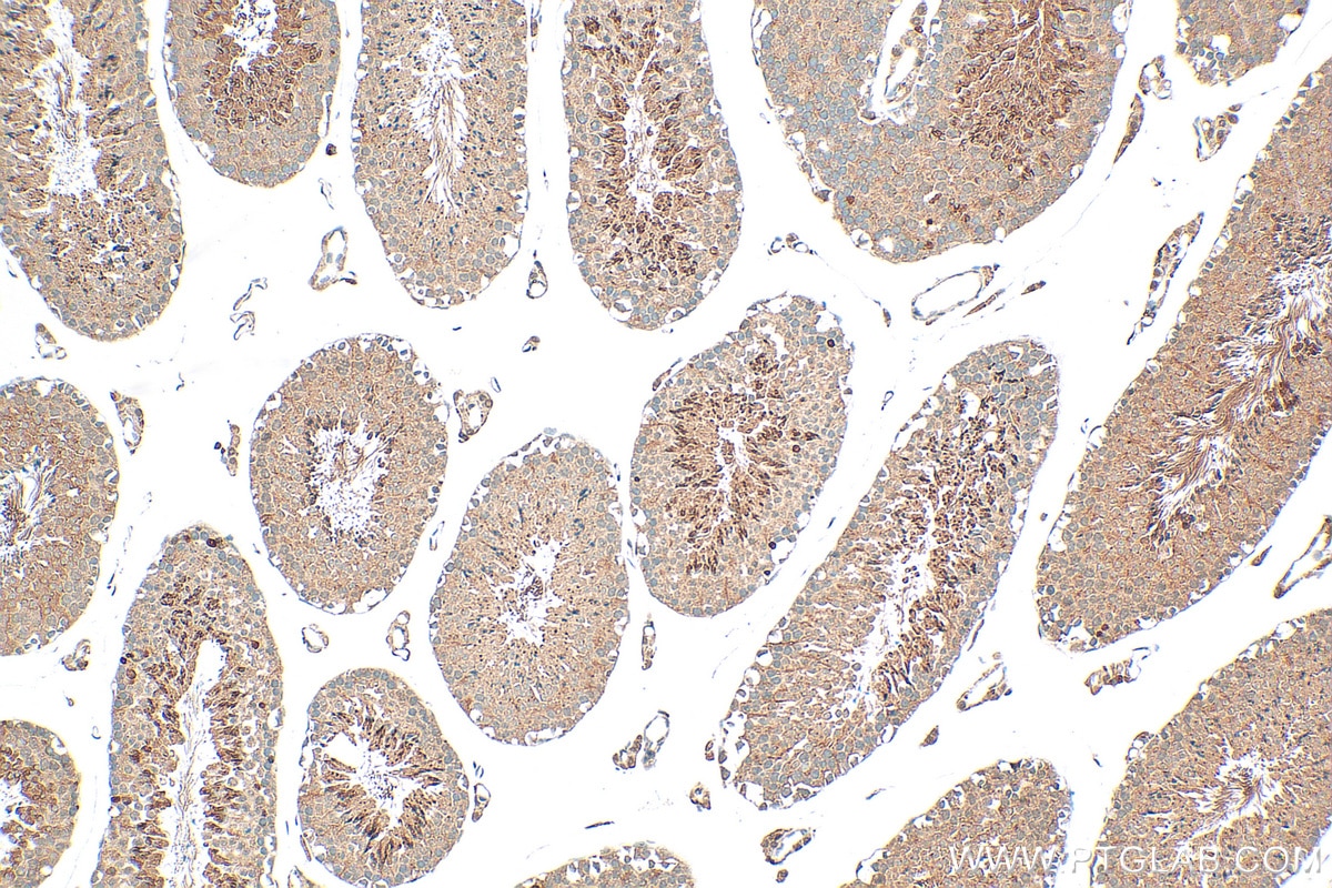 Immunohistochemistry (IHC) staining of mouse testis tissue using GGNBP1 Polyclonal antibody (18850-1-AP)