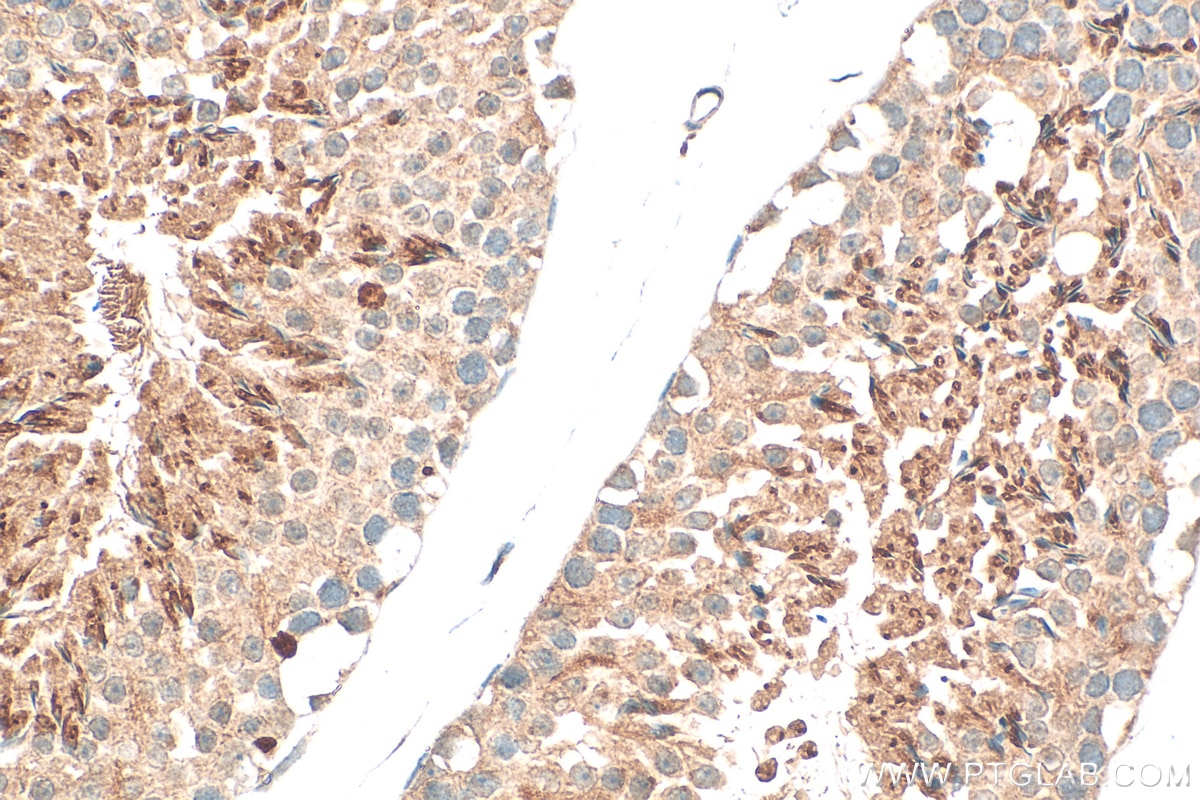 Immunohistochemistry (IHC) staining of mouse testis tissue using GGNBP1 Polyclonal antibody (18850-1-AP)