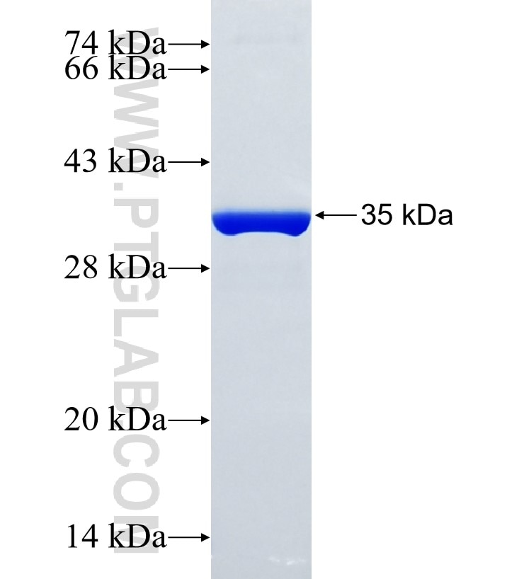 GGNBP2 fusion protein Ag24927 SDS-PAGE