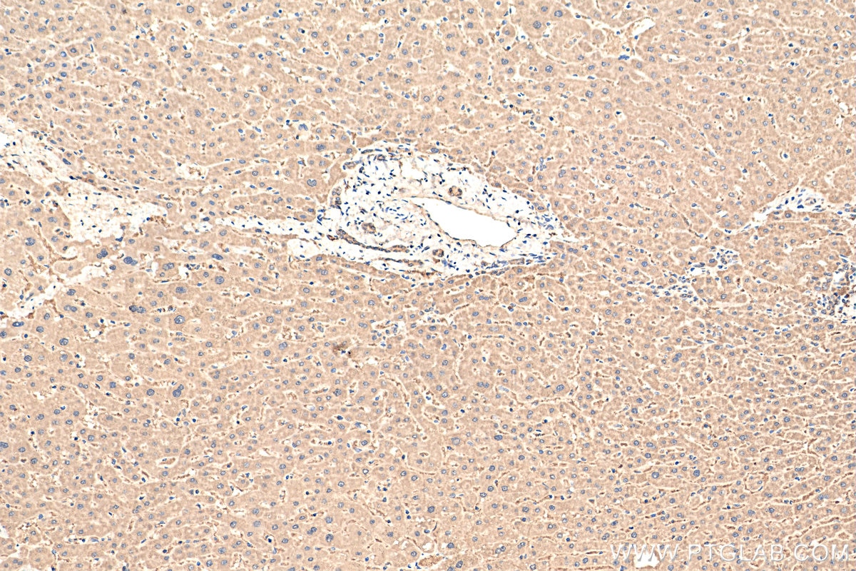 Immunohistochemistry (IHC) staining of human liver tissue using GGPS1 Polyclonal antibody (14944-1-AP)