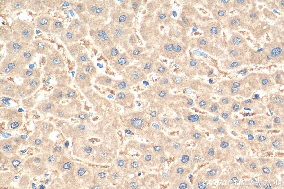 Immunohistochemistry (IHC) staining of human liver tissue using GGPS1 Polyclonal antibody (14944-1-AP)