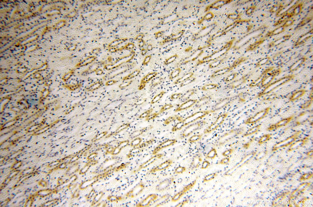 Immunohistochemistry (IHC) staining of human kidney tissue using GGPS1 Polyclonal antibody (14944-1-AP)