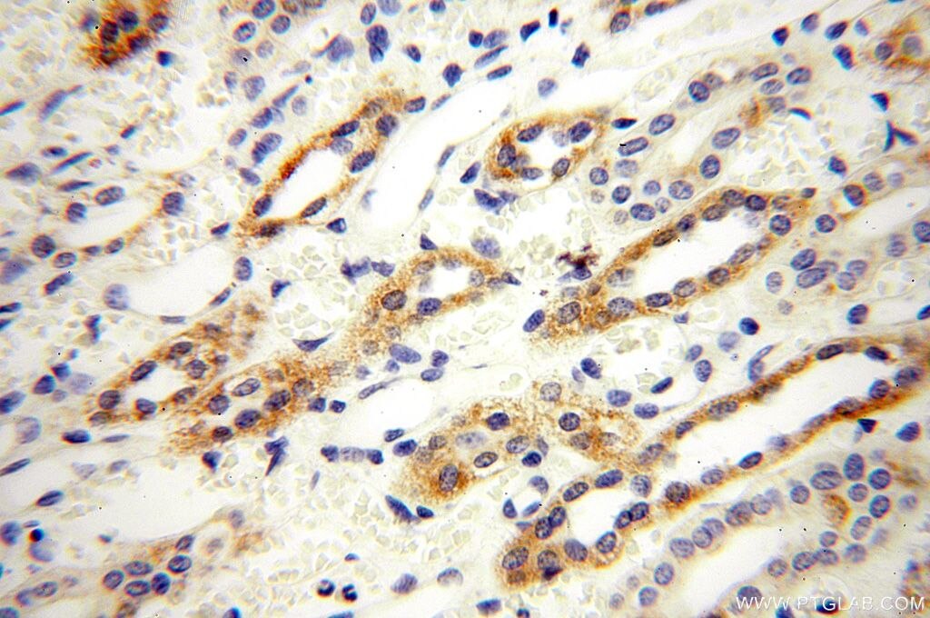 Immunohistochemistry (IHC) staining of human kidney tissue using GGPS1 Polyclonal antibody (14944-1-AP)