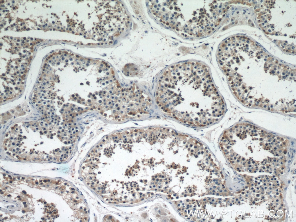 Immunohistochemistry (IHC) staining of human testis tissue using GGPS1 Polyclonal antibody (14944-1-AP)