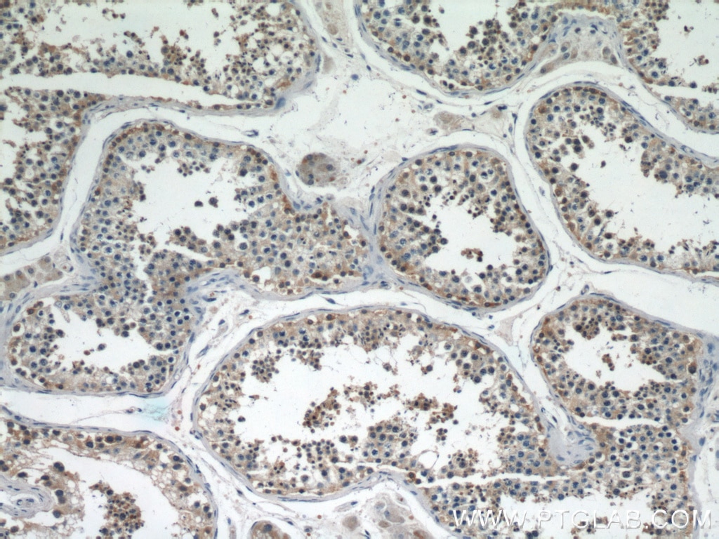 IHC staining of human testis using 14944-1-AP