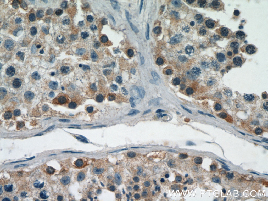 Immunohistochemistry (IHC) staining of human testis tissue using GGPS1 Polyclonal antibody (14944-1-AP)