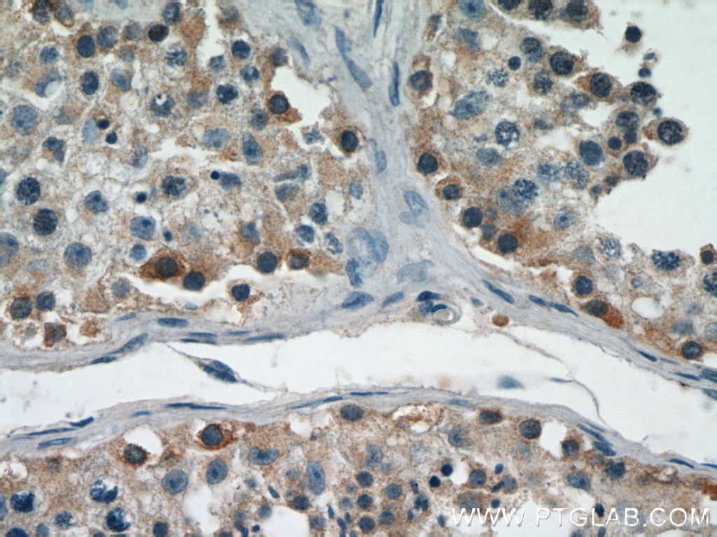 IHC staining of human testis using 14944-1-AP