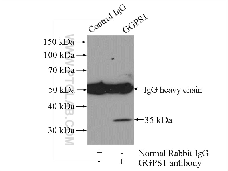 Immunoprecipitation (IP) experiment of mouse brain tissue using GGPS1 Polyclonal antibody (14944-1-AP)