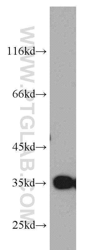 Western Blot (WB) analysis of human testis tissue using GGPS1 Polyclonal antibody (14944-1-AP)