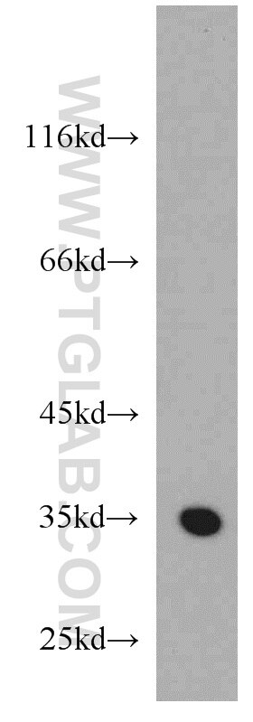 Western Blot (WB) analysis of mouse bladder tissue using GGPS1 Polyclonal antibody (14944-1-AP)