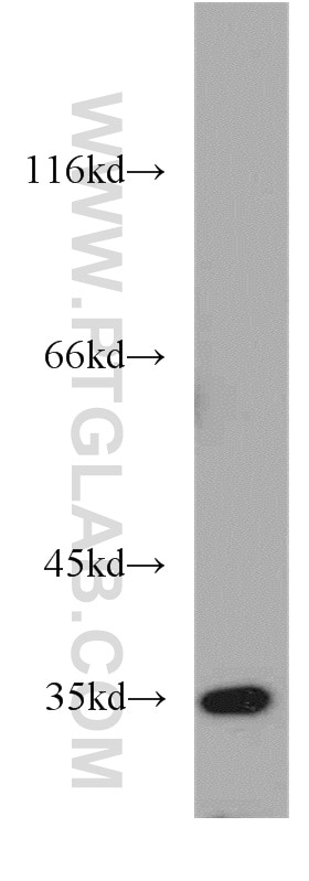 Western Blot (WB) analysis of mouse brain tissue using GGPS1 Polyclonal antibody (14944-1-AP)