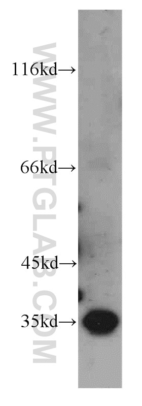 Western Blot (WB) analysis of human placenta tissue using GGPS1 Polyclonal antibody (14944-1-AP)