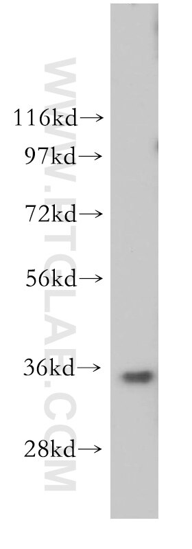 WB analysis of human heart using 14944-1-AP