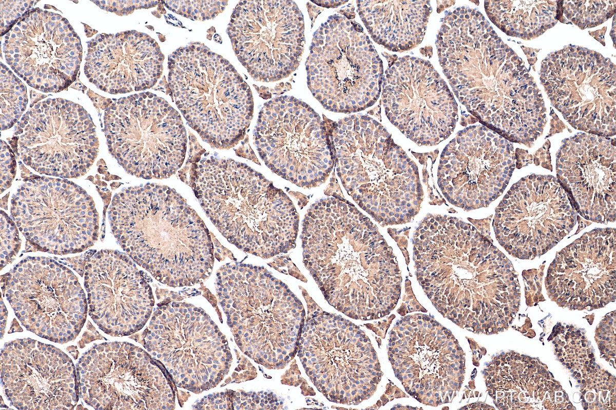 Immunohistochemistry (IHC) staining of mouse testis tissue using GGPS1 Polyclonal antibody (29707-1-AP)