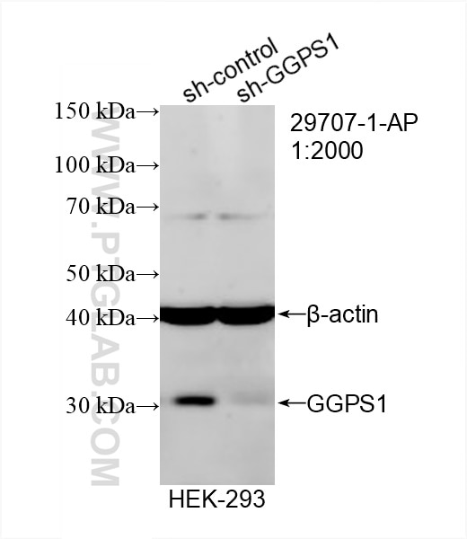 Western Blot (WB) analysis of HEK-293 cells using GGPS1 Polyclonal antibody (29707-1-AP)