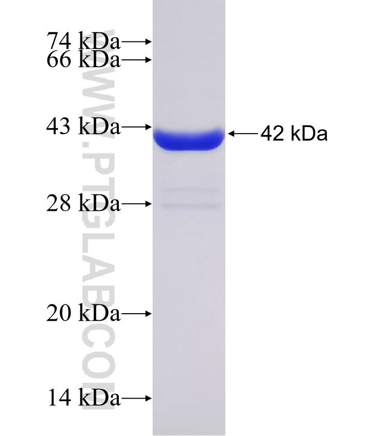 GGPS1 fusion protein Ag31476 SDS-PAGE