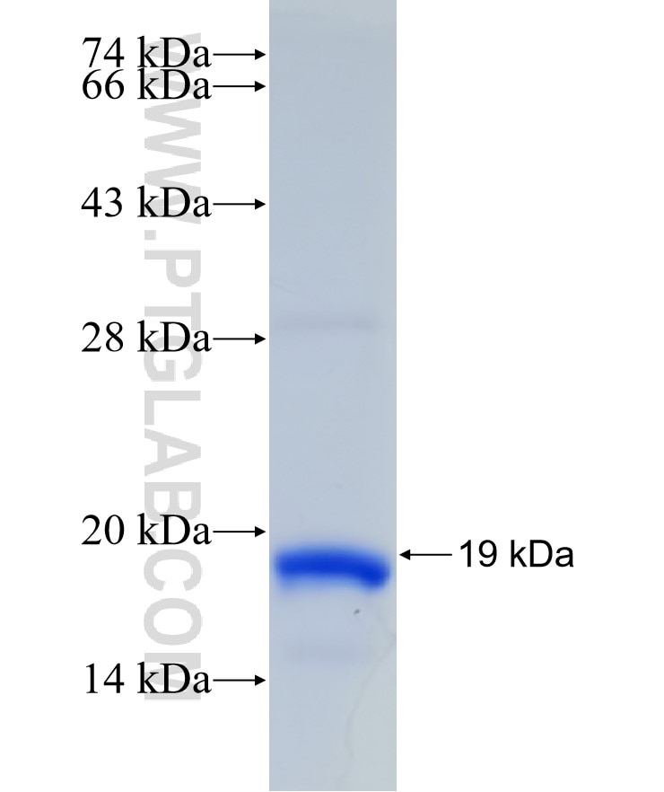 GGPS1 fusion protein Ag31490 SDS-PAGE GGPS1 fusion protein Ag31490 SDS-PAGE