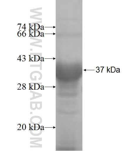 GGPS1 fusion protein Ag6370 SDS-PAGE