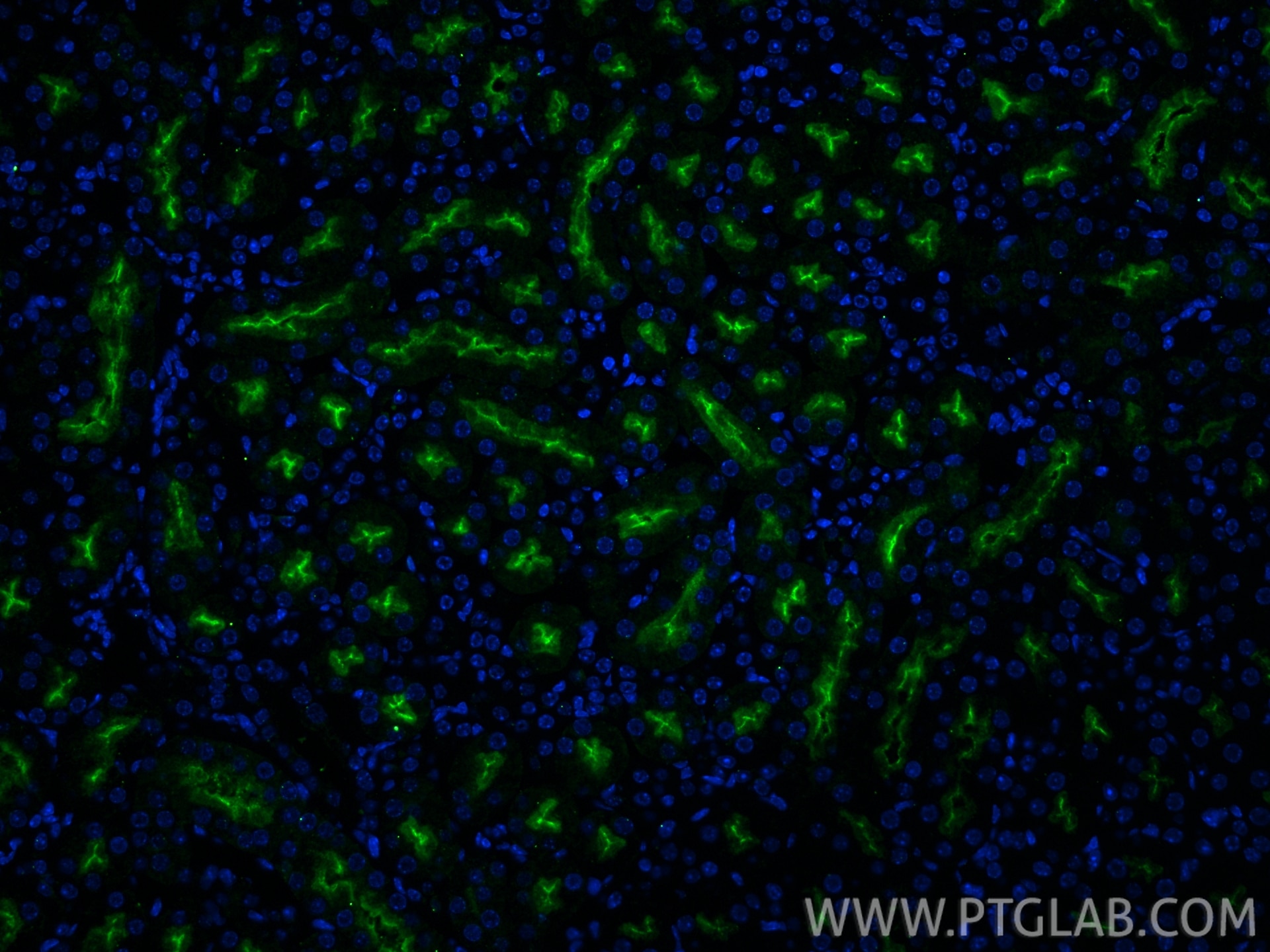IF Staining of mouse kidney using 33389-1-AP Immunofluorescence (IF) / fluorescent staining of mouse kidney tissue using GGT1 Polyclonal antibody (33389-1-AP)