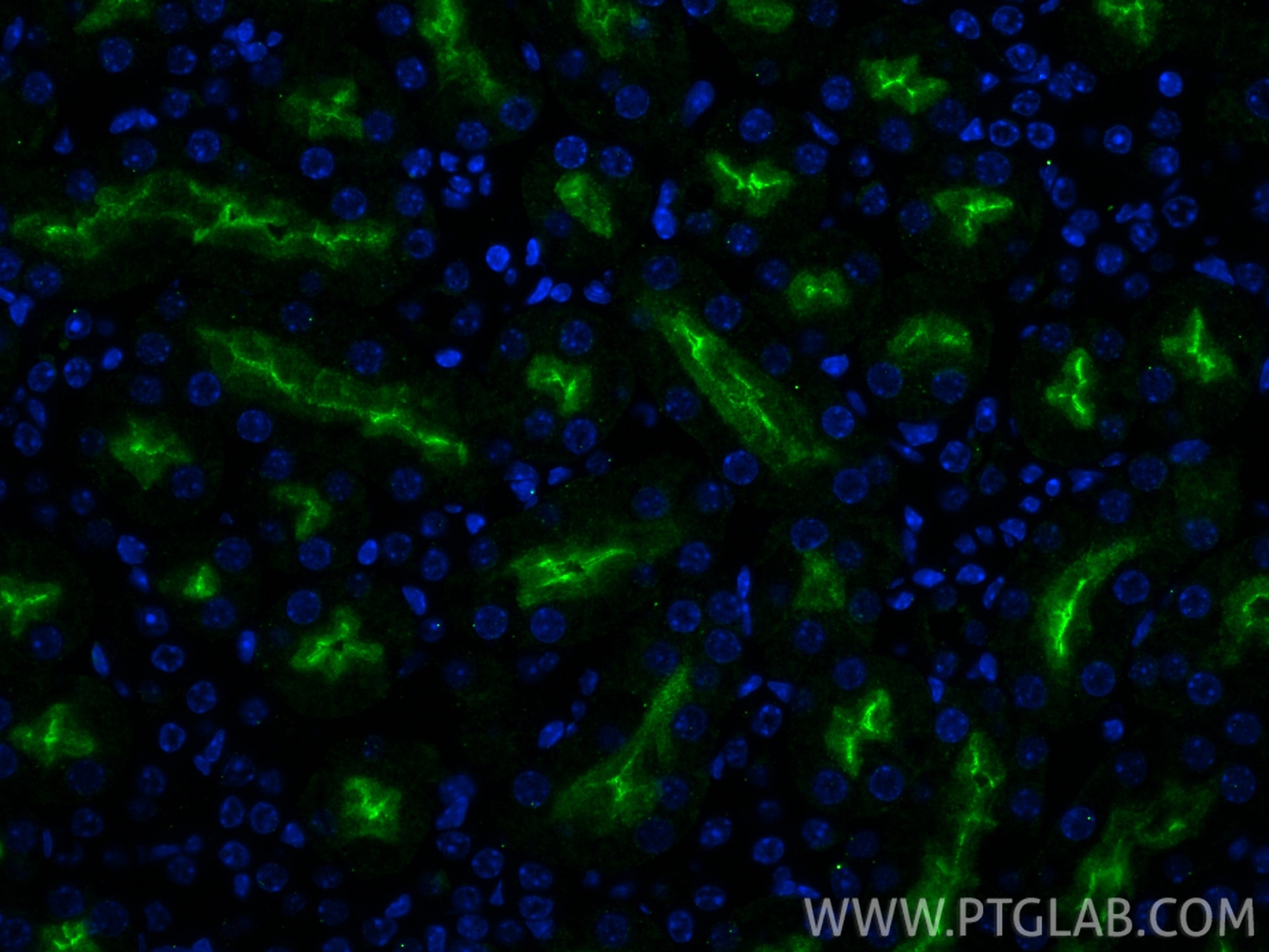 IF Staining of mouse kidney using 33389-1-AP Immunofluorescence (IF) / fluorescent staining of mouse kidney tissue using GGT1 Polyclonal antibody (33389-1-AP)