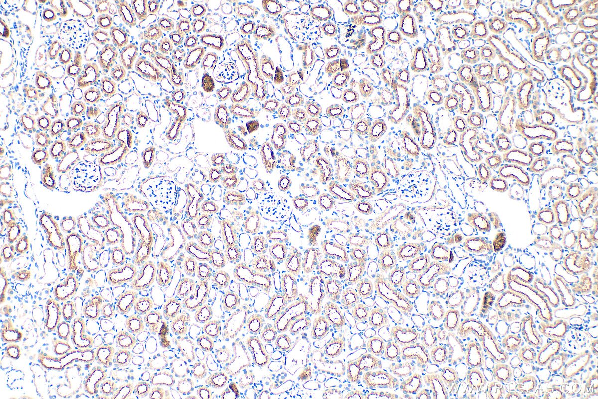 IHC staining of mouse kidney using 33389-1-AP (same clone as 33389-1-PBS) Immunohistochemistry (IHC) staining of mouse kidney tissue using GGT1 Polyclonal antibody (33389-1-AP)
