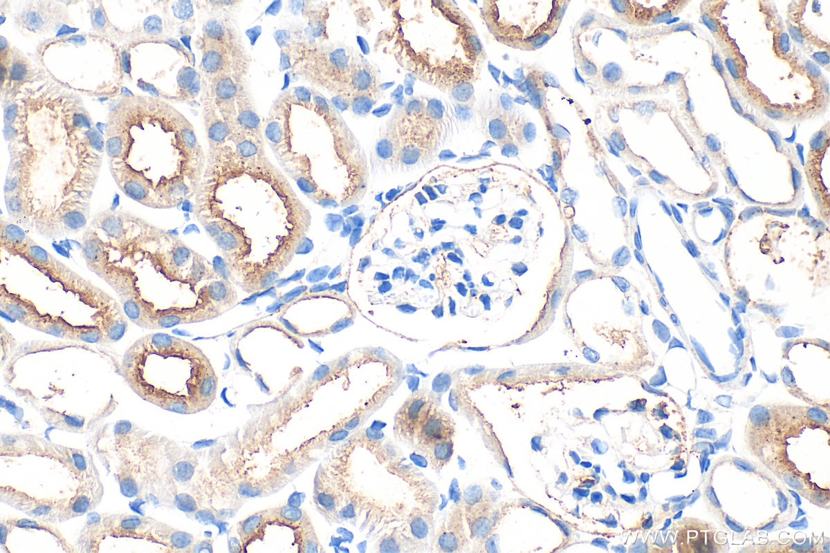 IHC staining of mouse kidney using 33389-1-AP (same clone as 33389-1-PBS) Immunohistochemistry (IHC) staining of mouse kidney tissue using GGT1 Polyclonal antibody (33389-1-AP)