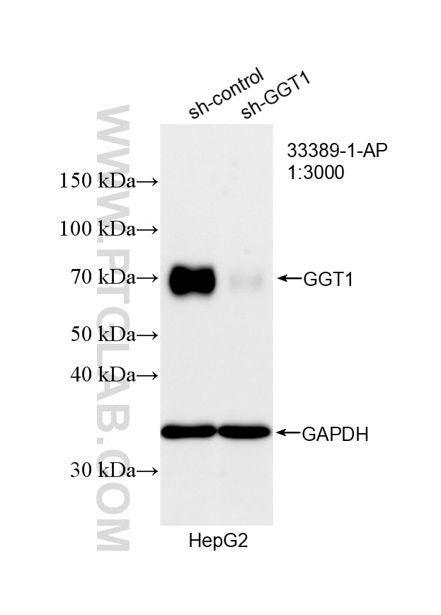WB analysis of HepG2 using 33389-1-AP Western Blot (WB) analysis of HepG2 cells using GGT1 Polyclonal antibody (33389-1-AP)