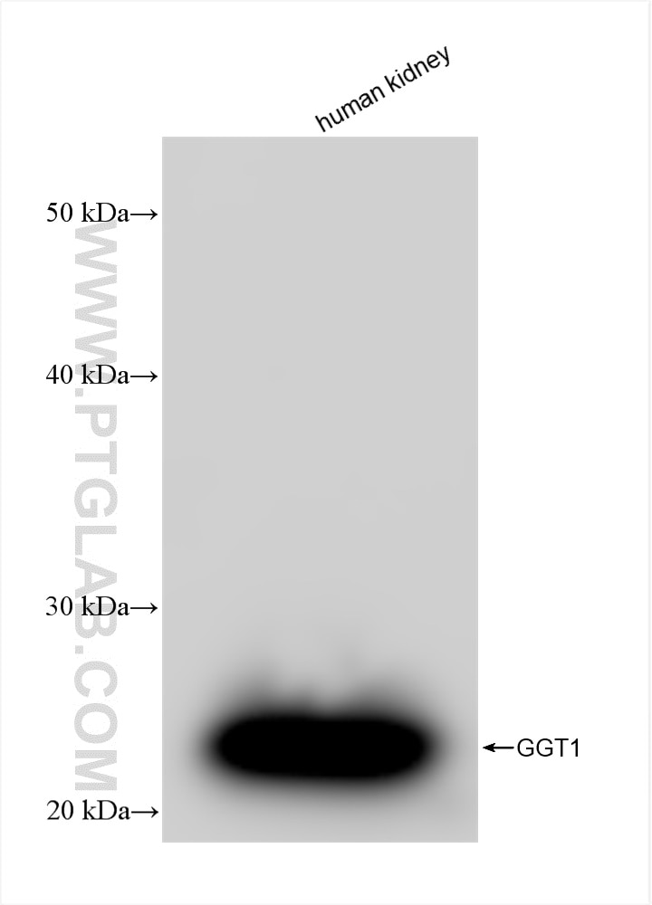Western Blot (WB) analysis of various lysates using GGT1 Recombinant antibody (83304-1-RR)